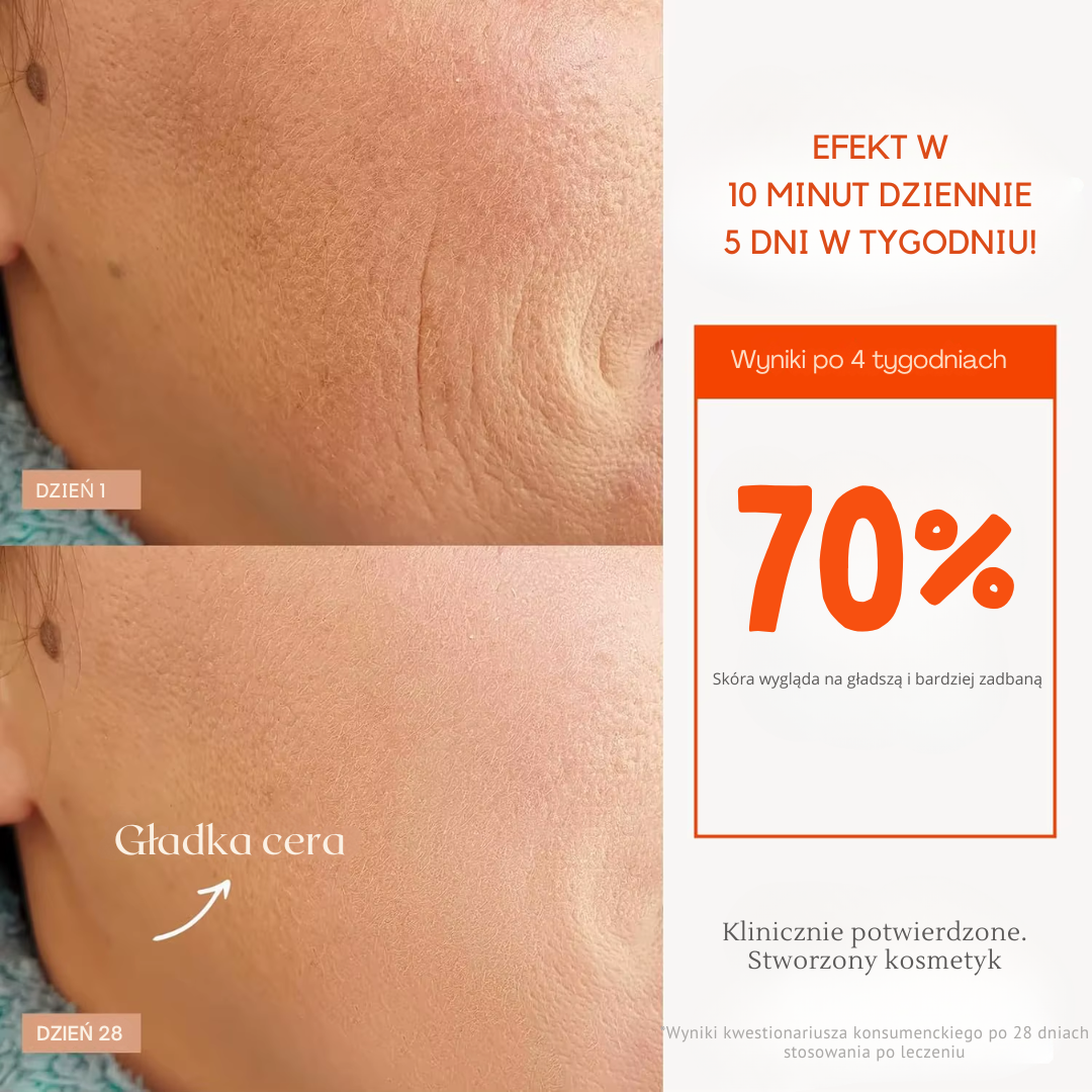 Promienna™ – Domowa pielęgnacja światłem LED